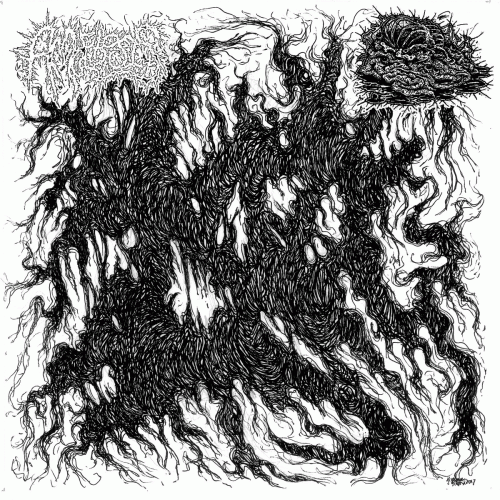 Botched Anastomosis J-Pouch : Amoebosis - Botched Anastomosis J-Pouch